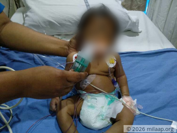 This one-month-old baby needs a heart surgery to survive