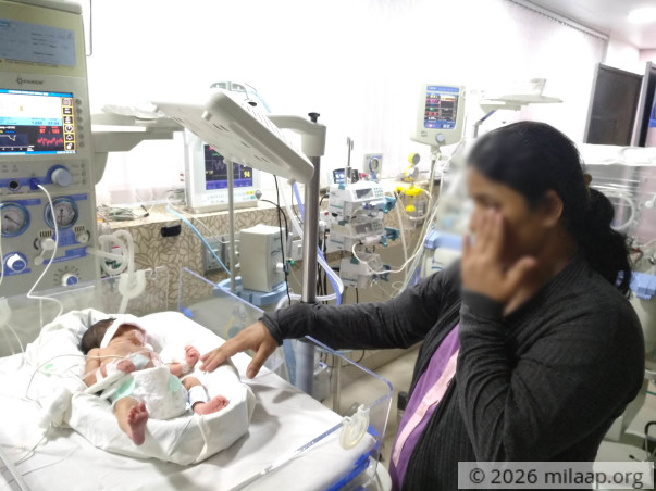 These Parents Are Struggling To Keep Their Twin Babies Alive