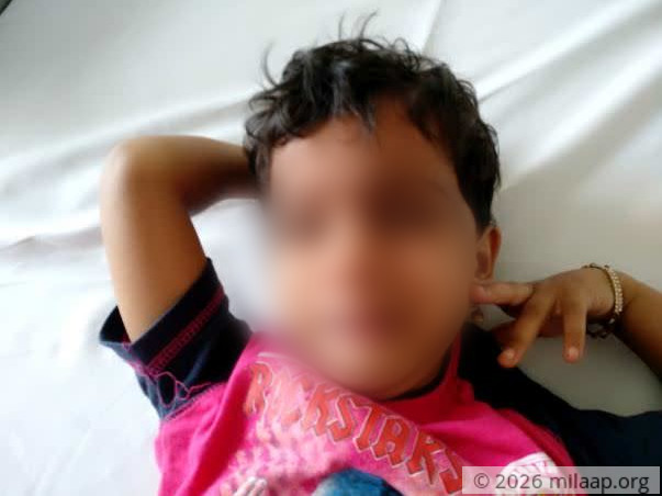 School Teacher's Daughter With 2 Massive Holes In Her Heart Needs Help