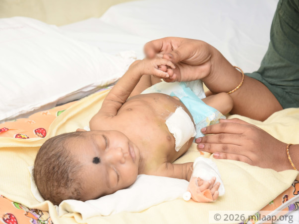 Bhargavi needs your help to undegro her treatment