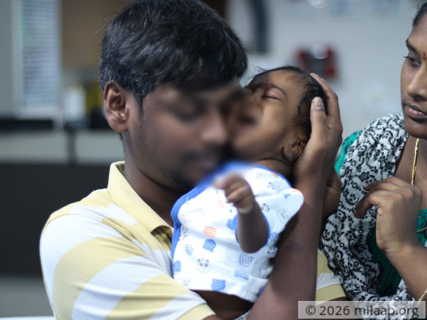 Help 5 months aged baby Sri divnesh undergo liver transplant