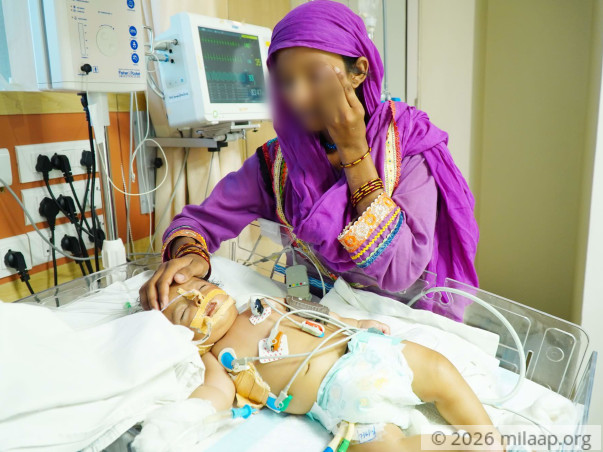 In Just A Week This Baby's Organs Started Failing, He Needs Help