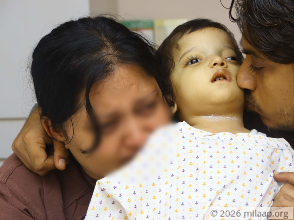 This 2 Year Old's Bones Can Crumble Due To A Rare Disease