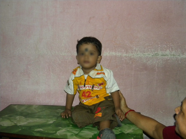 Help Baby Debrup Undergo Bone Marrow Transplant