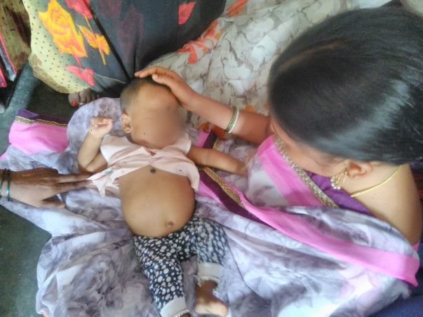 Help Required for Urgent Liver Transplantation For 6 months Old Baby