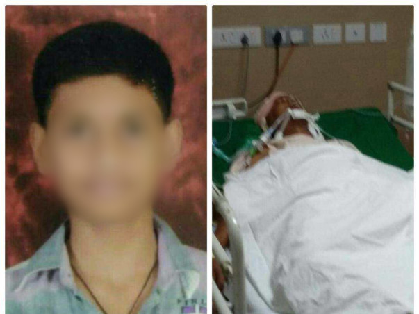 17-year-old Met With A Catastrophic Accident And Needs Your Help