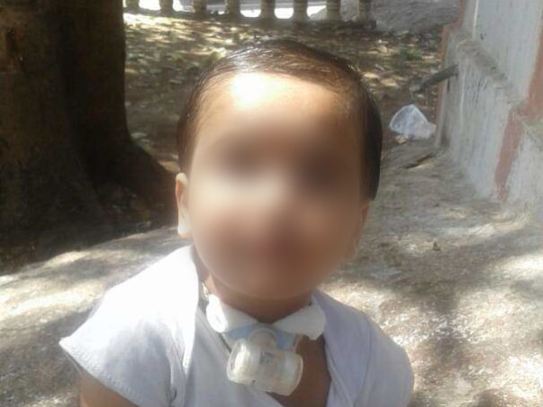 'Help Jathin fighting with major breathing problem'