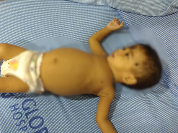 After Losing Two Babies, This Family Is Desperate To Save Their Child