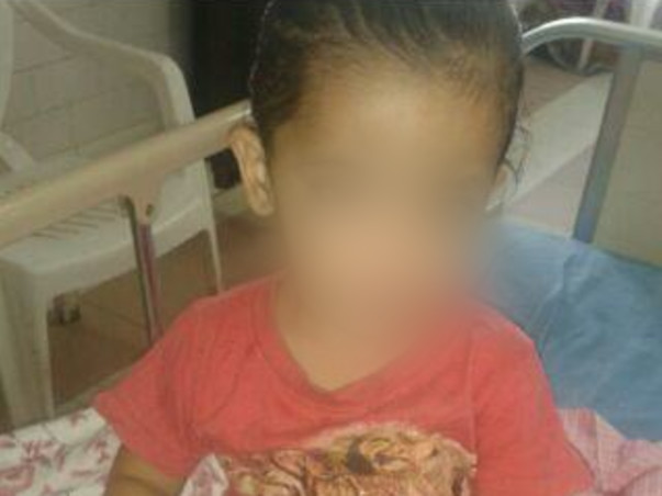 4-Year-Old Who Sweats Blood All Over Her Body Needs Urgent Help