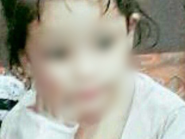 4-Year-Old Who Sweats Blood All Over Her Body Needs Urgent Help