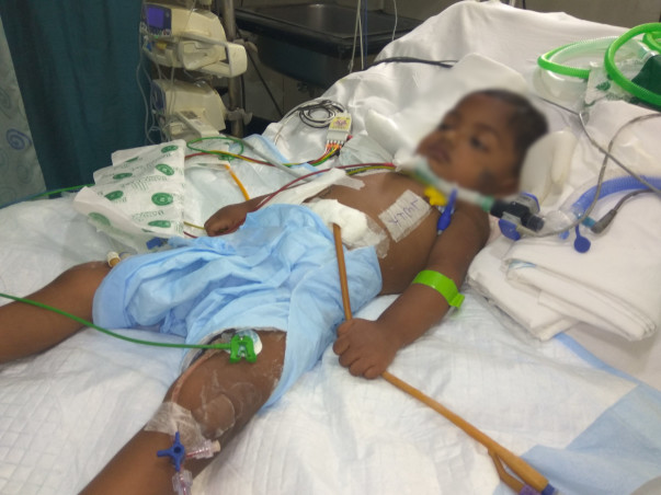 Their Child May Not Be Normal Anymore, Still They Wish To Save Him