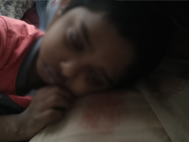 Help Srithan Fight With Leukemia