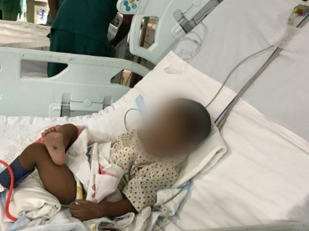 Little Lucky Will Not See His 2nd Birthday Without A Heart Surgery