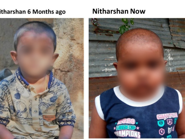Help Nitharshan Undergo Stem Cell Transplant