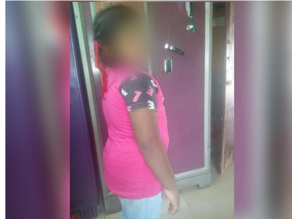 Your Help Can Save 10-Year-Old Shivani From Getting Paralysed