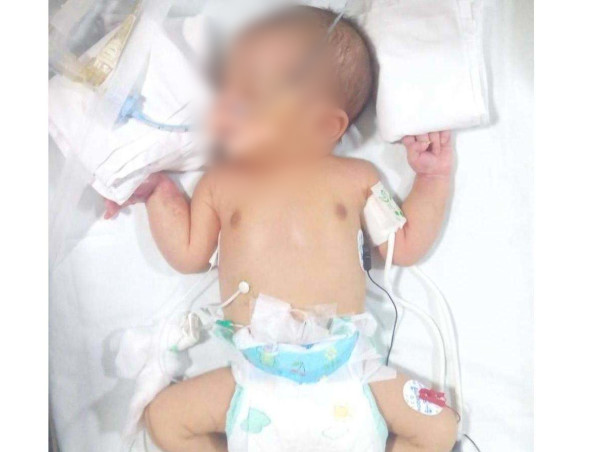 Save This Newborn Who Was Found Abandoned On The Road In Bengaluru