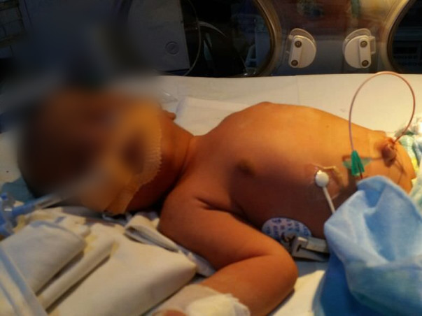 Save This Newborn Who Was Found Abandoned On The Road In Bengaluru