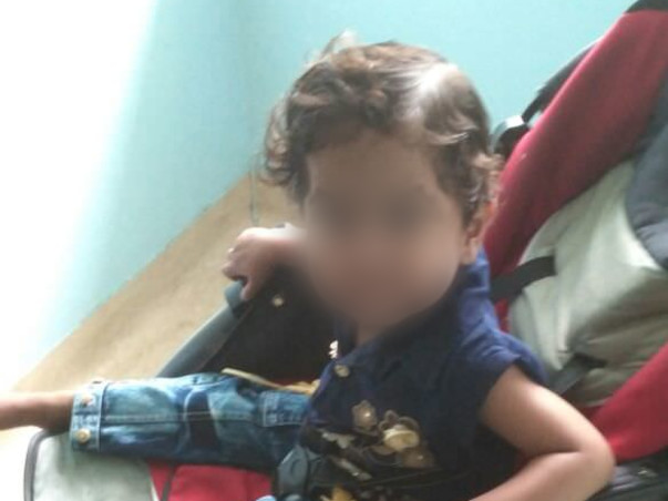 3-Year-Old Baby With Stunted Growth Because Of A Heart Defect