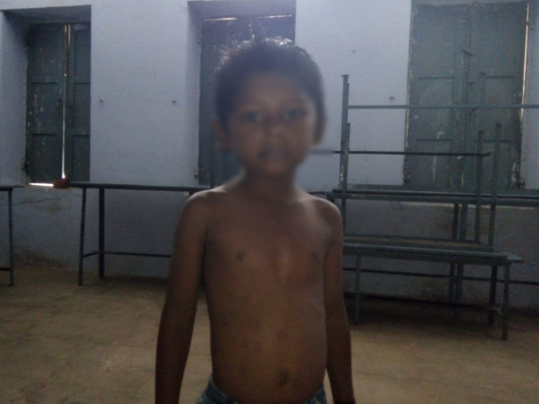 Help 5-year-old-Annamalai undergo heart surgery