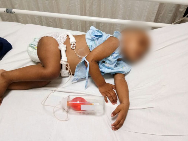 2-year-old Aniketh urgently needs your help to fight Liver Cancer