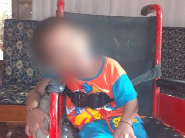 Plize help baby Alun .. As he needed  stem cell therapy or bone marrow