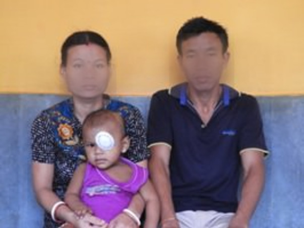 1-year-old Dhanjit Has Eye Cancer And Needs Our Help For Treatment