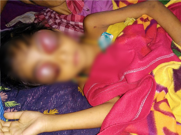 Help Dhanika To Fight Against Leukemia