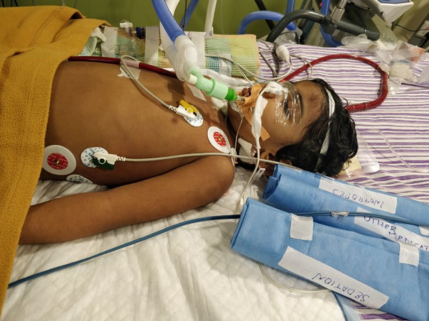 You Can Save 3-year-old Sandhiya Who Is On Artificial Lung Machine