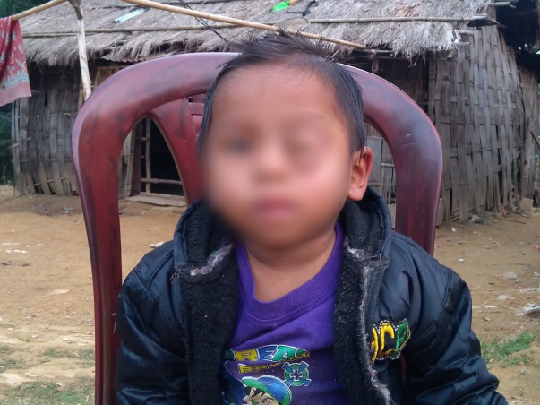 Baby Keffrien's Eye Has Been Ravaged By Cancer, Save His Life