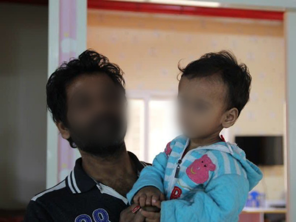 1-Year-Old Juie Needs Your Help To Fight Eye Cancer