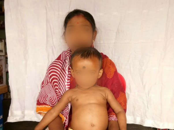 My 1-year-old Boy Who Has Cancer And Is Just Too Sick To Smile Anymore