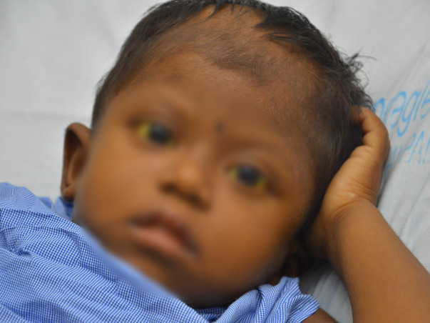 Help 4-Year-Old Who Scratches Skin and Pulls Hair Out In Pain