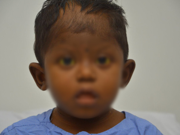 Help 4-Year-Old Who Scratches Skin and Pulls Hair Out In Pain