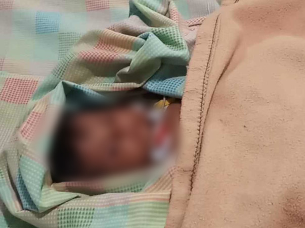 This 3-Month-Old Baby Girl Cannot Eat And Sleep, She Passes Blood