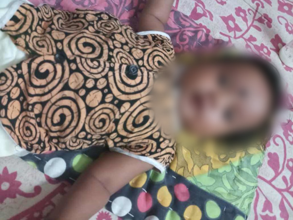 This 3-Month-Old Baby Girl Cannot Eat And Sleep, She Passes Blood