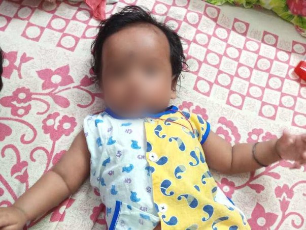 This 3-Month-Old Baby Girl Cannot Eat And Sleep, She Passes Blood