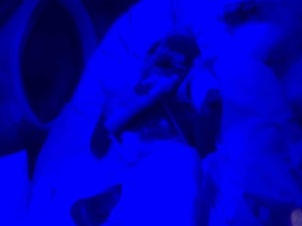 Baby of Vinod needs your help to survive