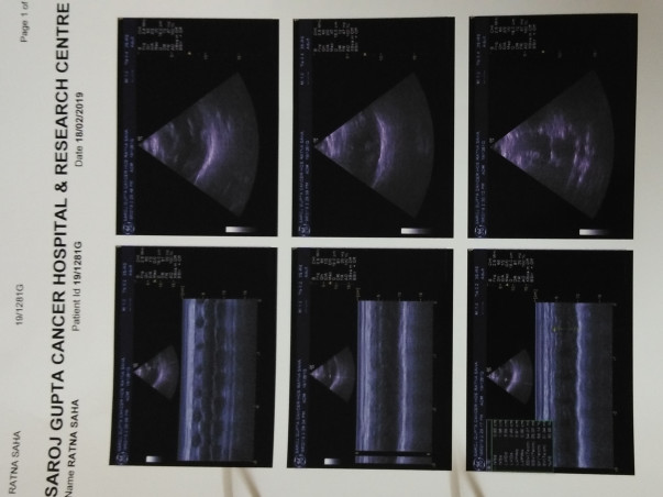 Help My Mother Fight Lung Cancer