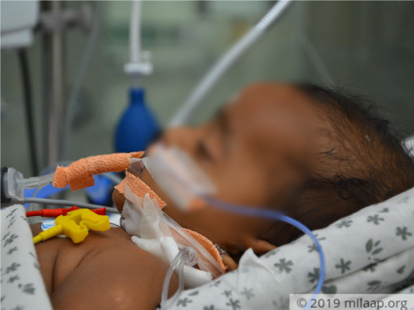 Help 5-month-old Who Had Seizures And Is The ICU With Brain Fever