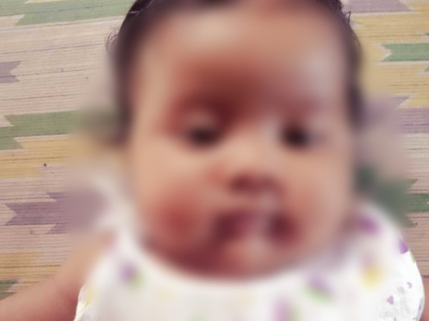 Help 5 month old Ayantika(Titli) fight Heart disease