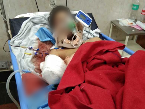 Class-9 Boy Lost His Hands And Leg After A Train Ran Over Him