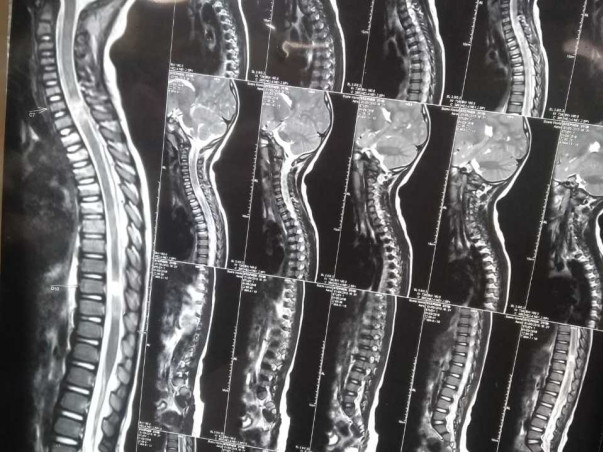 Help Sekhar For His Son's Treatment