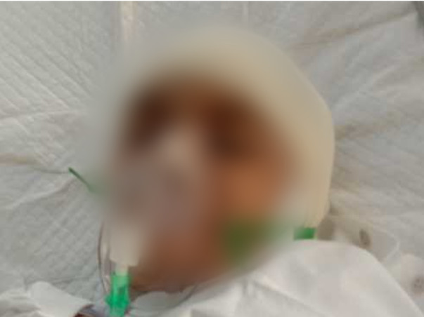 Help 09-year-old Dhruv Recover From Rare Brain Disease