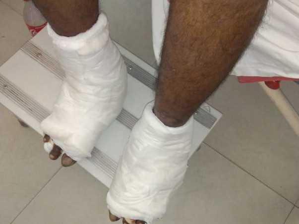 Help my Friend recover from Pheriperal arterial diseases.