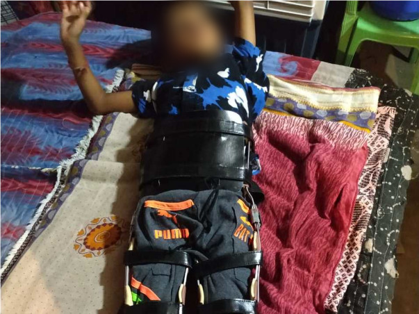 Support 5 years old Stephan who met with an accident and is paralyzed.