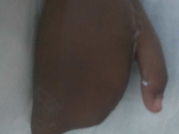 Help Vaishnavi Recover