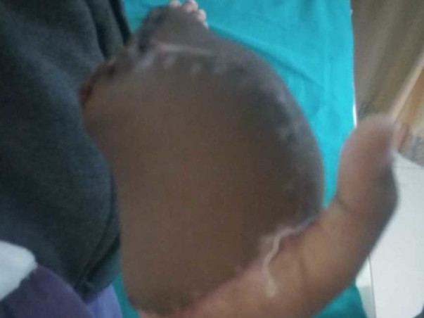 Help Vaishnavi Recover