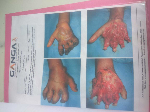 Help Vaishnavi Recover