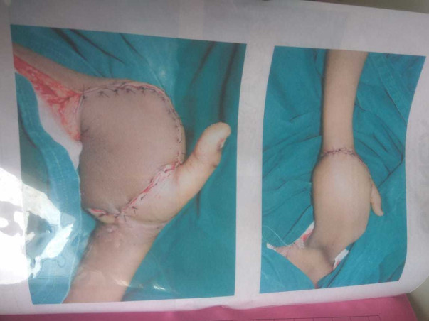 Help Vaishnavi Recover