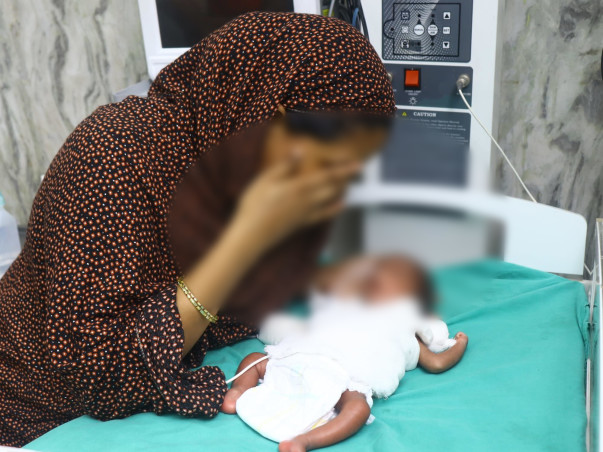 Baby of Akeel needs your help to survive